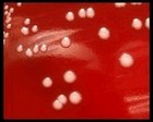 staphylococcus epidermidis on blood agar